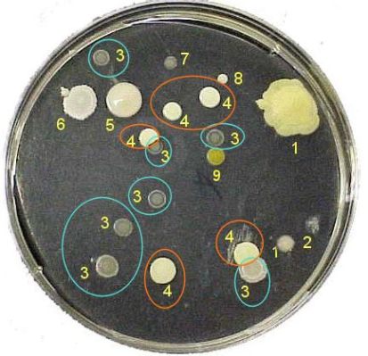   Acinetina: En liten cirkel med en stor aptit för bakterier!