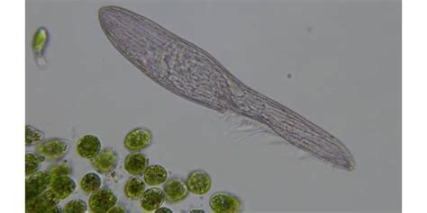  Blepharisma! En mikroskopisk värld av förbryllande fjädrar och fascinerande fläckar